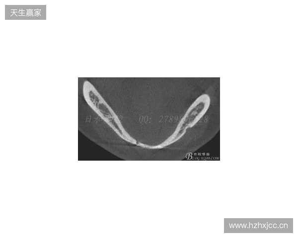 韦林顿确诊上唇部贯通伤;11、21牙半脱位;上颌前牙区牙槽骨骨折